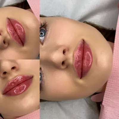 Oliwia Piernicka Estetyka Twarzy powiekszanie ust Tczew